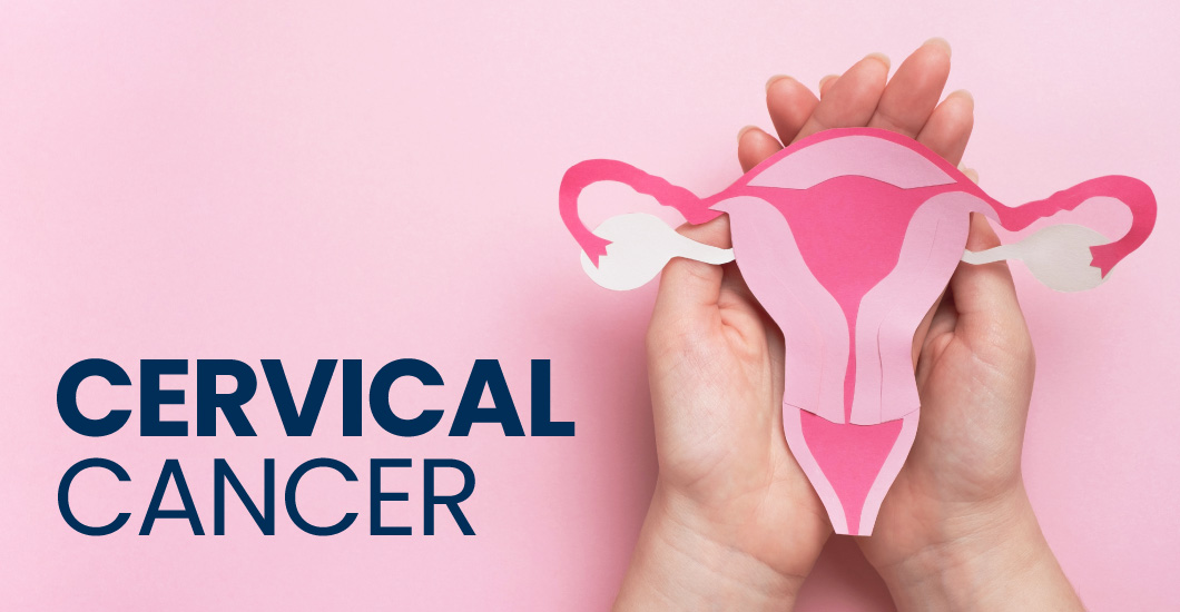 What are the cervical cancer stages?
