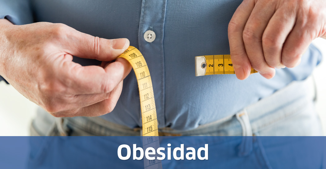 Obesidad