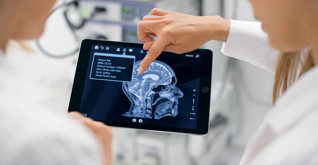 Stroke warning signs: how to spot one and protect your brain